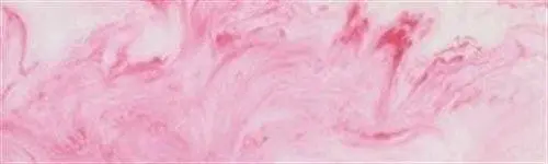 1" X 1 1/2" X 5" Knife Blank Raspberry Parfait Acrylester #68 1